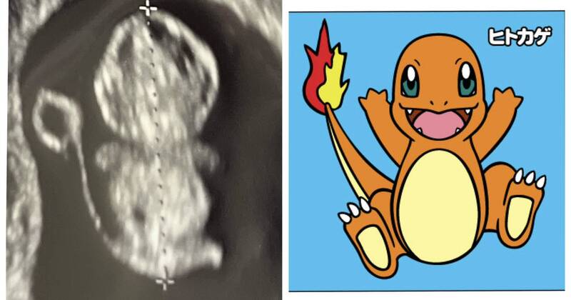 大獎娛樂城、大獎娛樂-線上新聞-超音波驚見「神獸降臨」！ 產檢照驚現小火龍！網笑瘋：難道親媽是噴火龍？